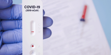 Se întâmplă la alții | De azi, în Austria se pot face teste antigen Covid-19 GRATUITE  la medicii de familie. Rezultatul, în 15 minute
