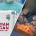Medici trimişi în judecată pentru trafic de organe / Şi-au făcut afacere din importul ilegal a sute de cornee