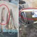 Un medic a uitat frâna de bicicletă în rana unui pacient. ”Când am urcat treptele pur și simplu a pleznit pielea din jurul cusăturii”