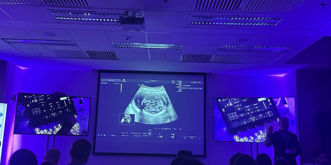 Specialiștii în sonografie fetală, la cursul  Voluson User Days