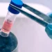 Donatorii de celule stem vor beneficia de asigurare de sănătate gratuită